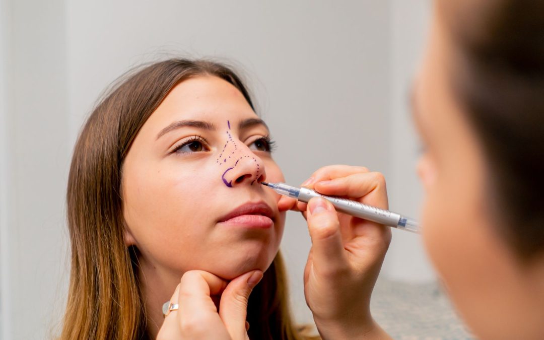 Negligencia Médica en Rinoplastia