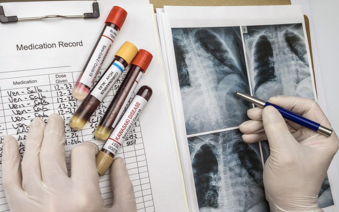 Cómo Evitar Errores de Diagnóstico en Enfermedades Raras