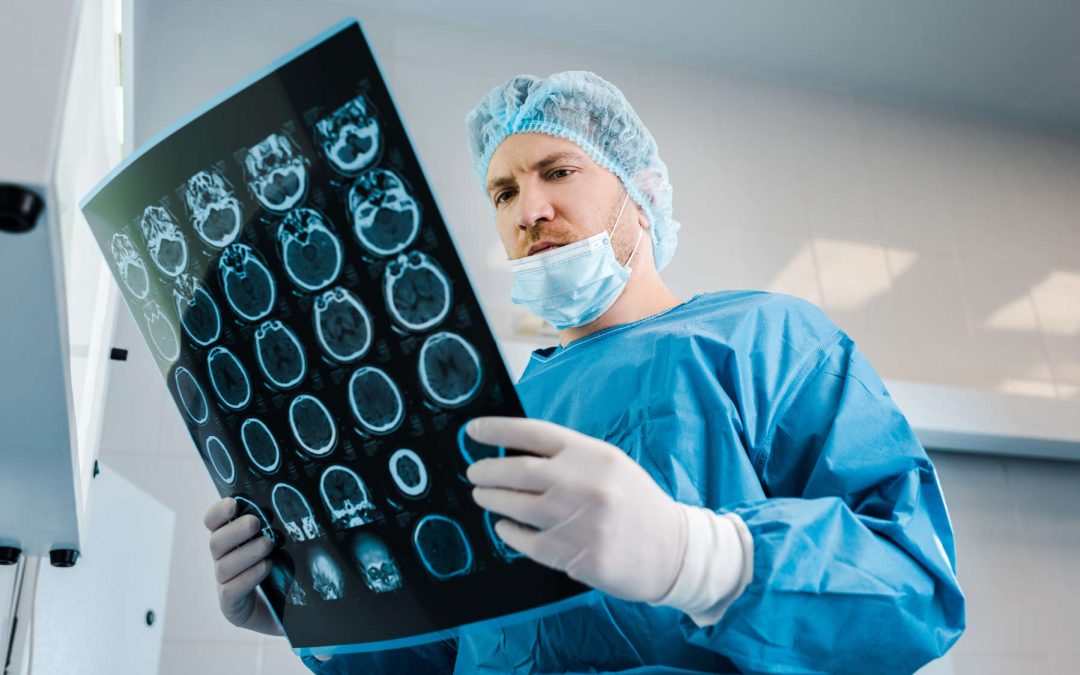 Negligencia Médica en Neurocirugía: Ejemplos y Reclamaciones