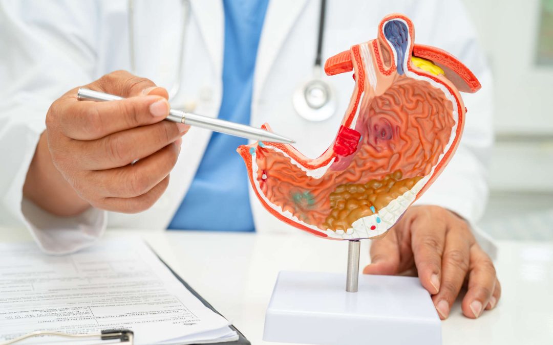 Negligencias en Diagnósticos y Tratamientos de Enfermedades Digestivas