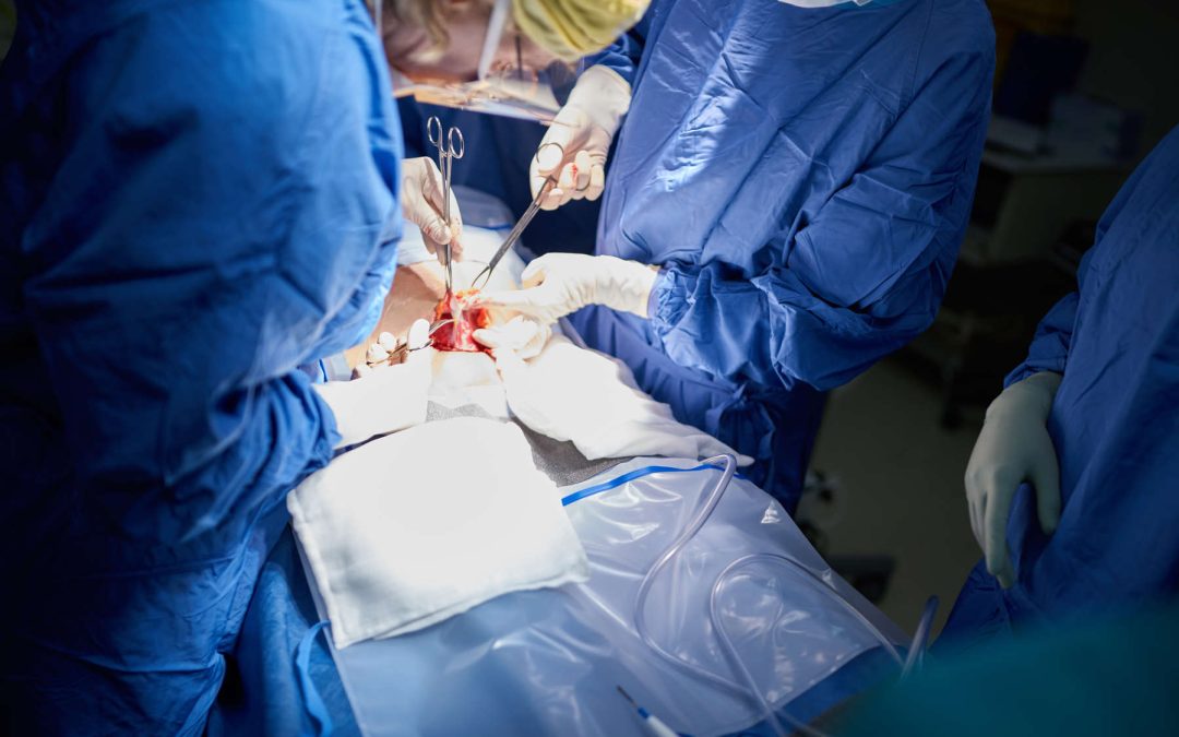 Consecuencias de los Errores en Procedimientos de Trasplante